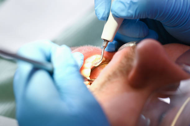 Best Chipped Tooth Repair Near Me  in Web, AL