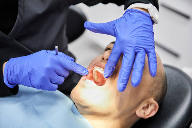 Best Broken Tooth Emergency  in Web, AL